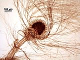 7 - Dettaglio di un carposporofito